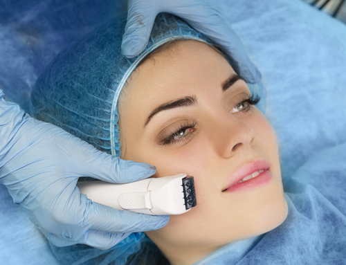 PRP Injections With Chemical Peel